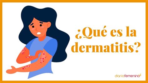 que es la dermatitis-1